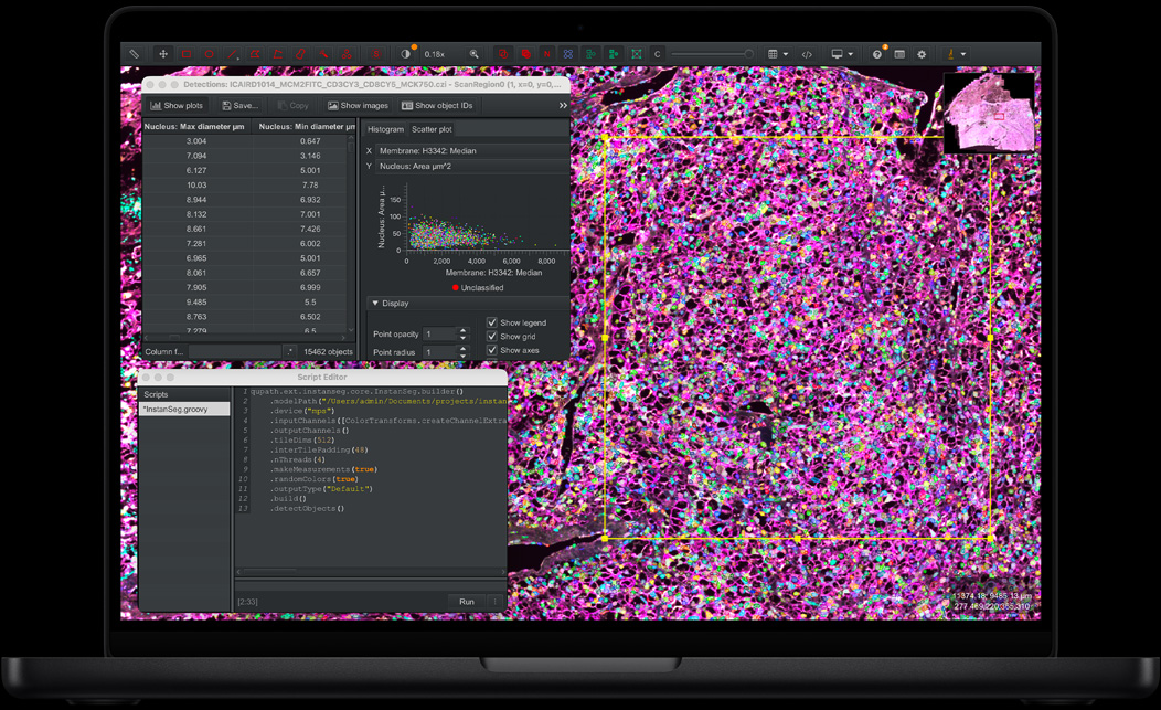 MacBook Pro, QuPath, lyserød, lilla og grøn vævsprøve farvet med fluorescerende farvestof, Script Editor-panel med kode, registreringstabeller med målinger af diameter på kernen og en spredningsoversigt